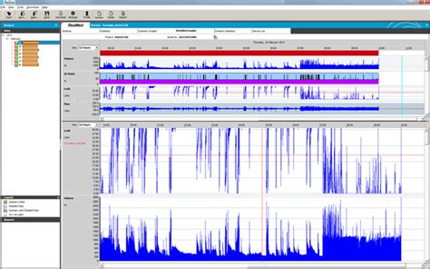 ResScan™ patient data management s